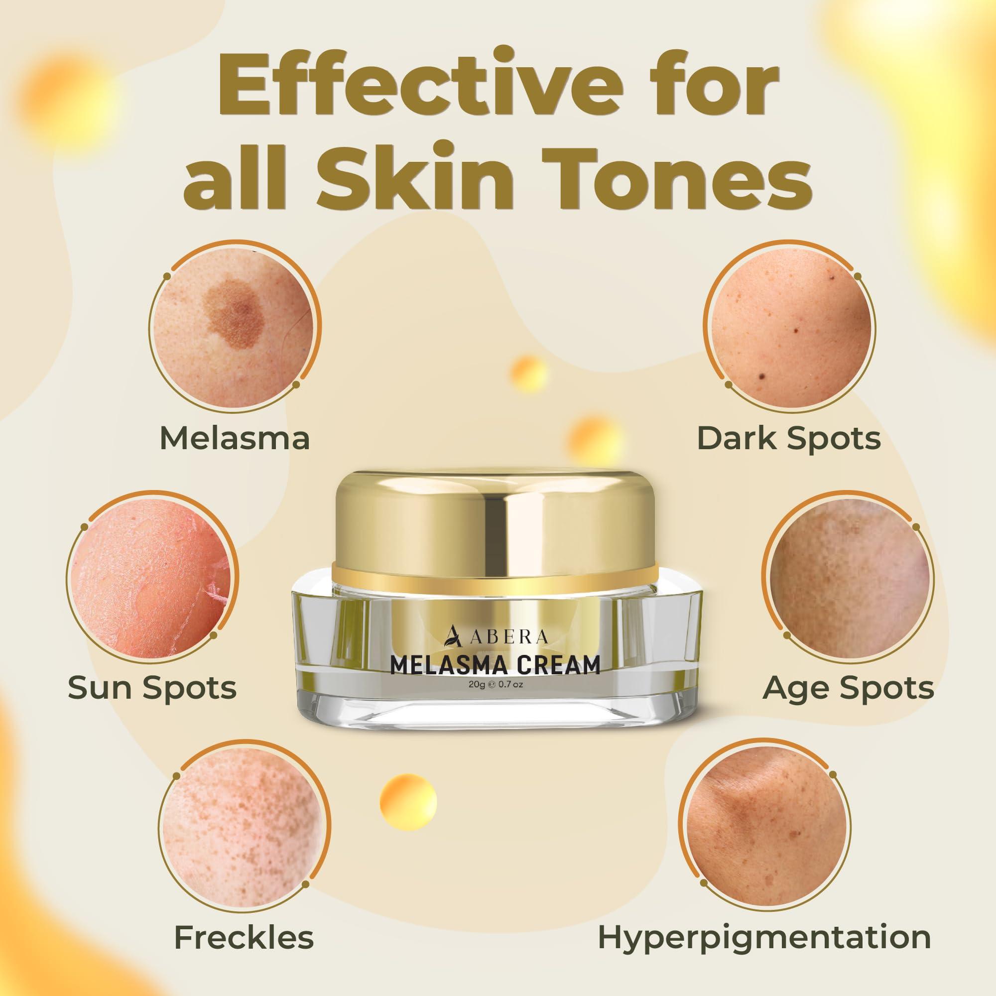 ABERA ABERA Dark Spot Remover for Face: Dark Spot Corrector for Age Spot Sun Spot Freckles Melasma Brown Spot - Faded Spot Correcting Cream for Face Hands (3 Boxes)