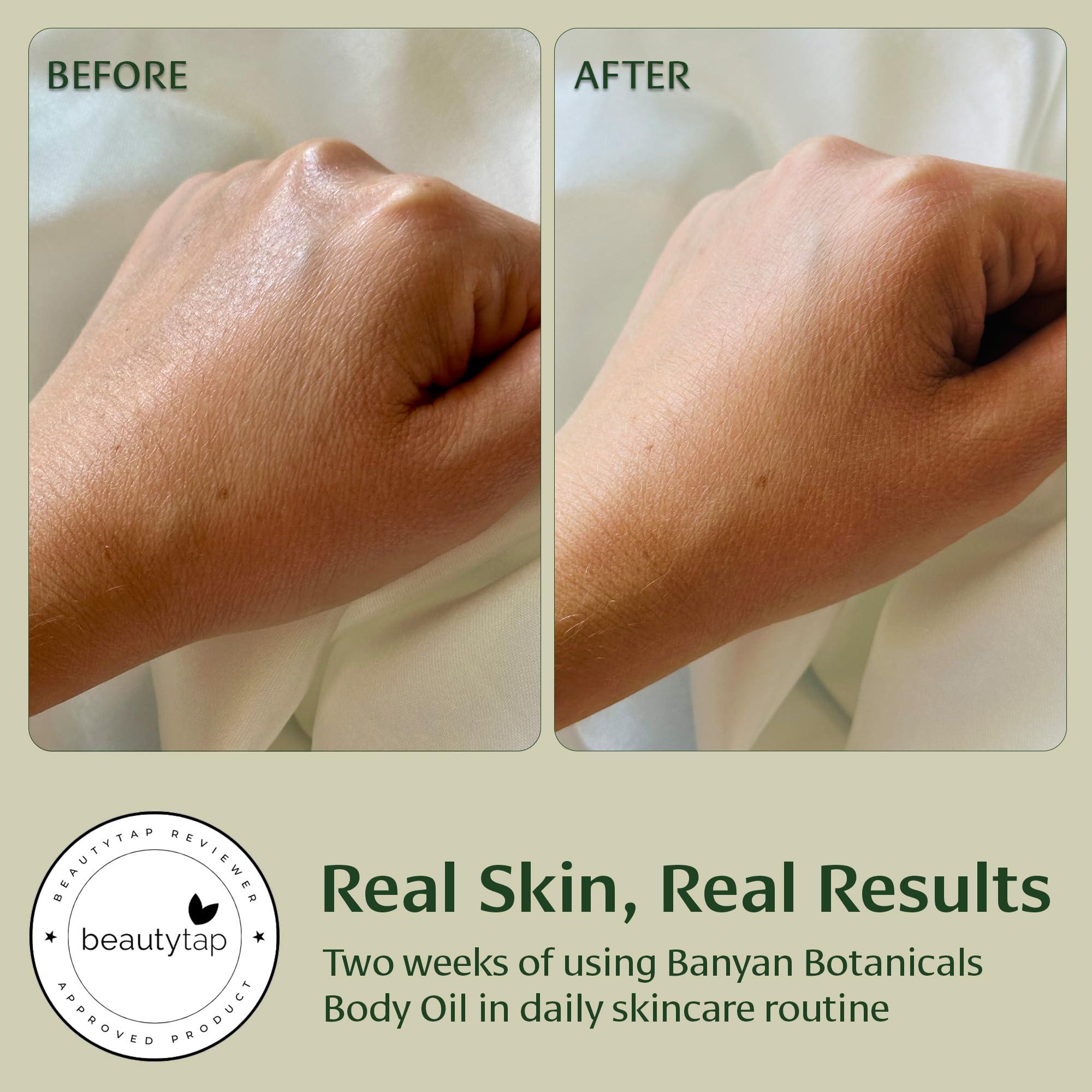 Banyan Botanicals Banyan Botanicals Body Oil Lightweight & Non-Greasy Body Oil Ayurvedic Skin Care with Organic Jojoba Oil & Herbs for Soft, Smooth Skin 4 oz Non-GMO, Cruelty Free, Paraben Free Massage Oil