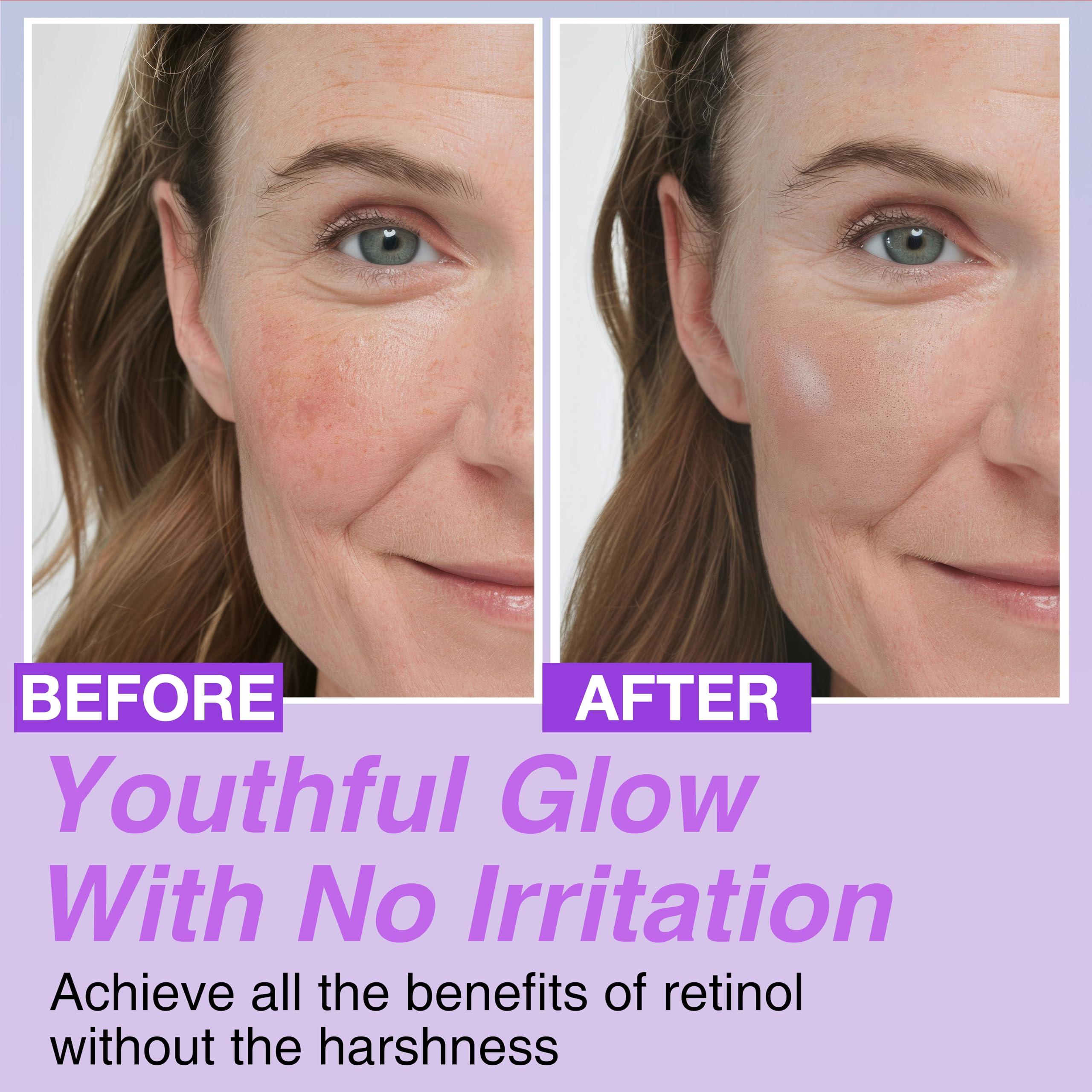 CELDYQUE Korean Bakuchiol Concentrate DIY Mix-in Serum 30,000 ppm - High Potency Retinol Alternative | Wrinkle Reduction Skin Firming & Smoothing - Anti-Aging Sensitive Skin Vegan & Cruelty-Free Non-GMO 1 oz