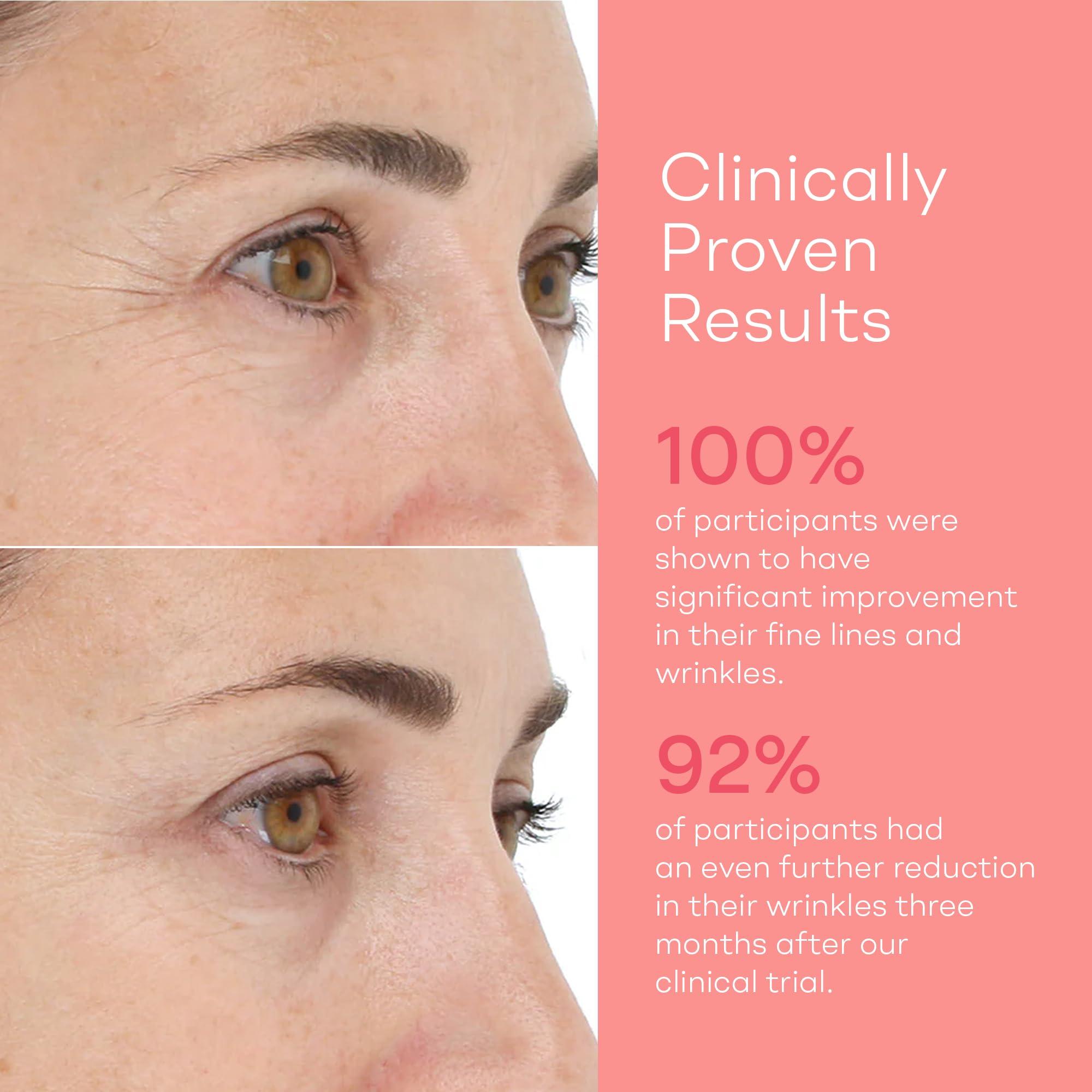 LightStim LightStim for Wrinkles LED Red Light Therapy with 72 LEDs (605, 630, 660, & 855 nm Wavelengths). Reduces Fine Lines, Wrinkles, Rejuvenates Skin, and Maintains a Youthful Appearance FDA Cleared White