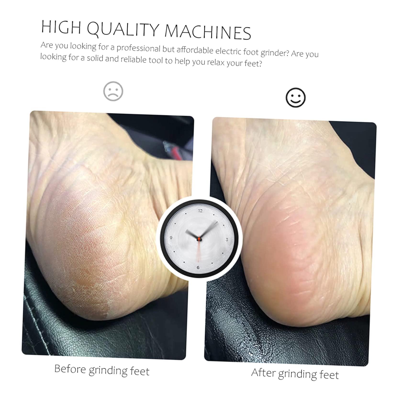 Housoutil Housoutil Rechargeable Foot Dead Skin Remover Electric Grinder for Feet Hard Skin Remover Foot Pedicure Foot Care Tool Foot Sc Hard Skin Rem