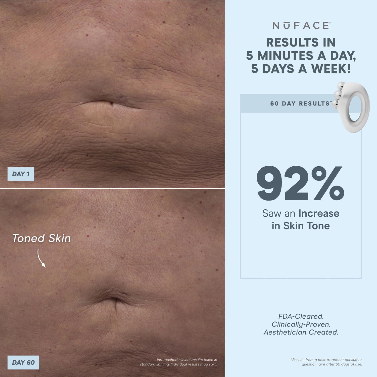 NuFACE NuFACE NuBODY Toning Device - FDA Cleared Microcurrent Device for All-Over Contouring, Firming & Skin Tightening