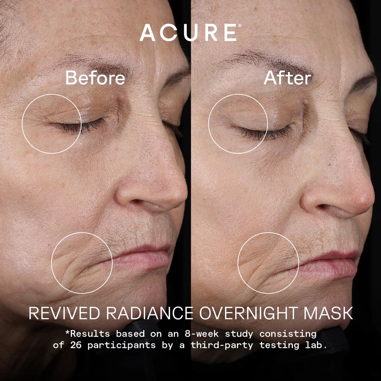 Acure Acure Revived Radiance Overnight Mask, for Fine Lines, Wrinkles & to Restore Overall Radiance to Tired Lackluster Skin, 1.7 Fl Oz