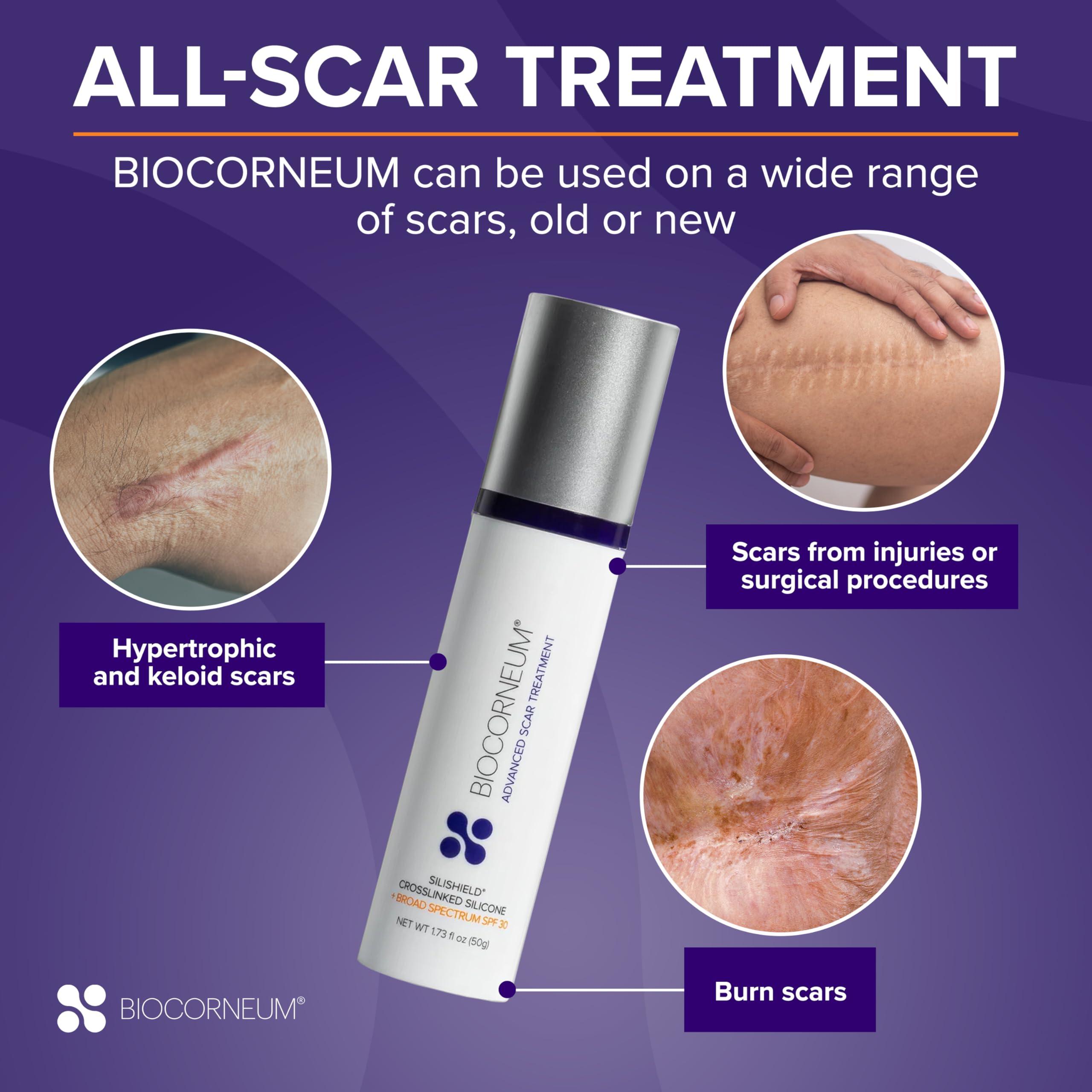 bioCorneum Advanced Scar Treatment with Silishield & SPF 30 20g Made in the USA, Fast-Drying, Water-Resistant Silicone Scar Gel - Surgeon Recommended for New & Old Scars - Suitable for Children Over 6 Months