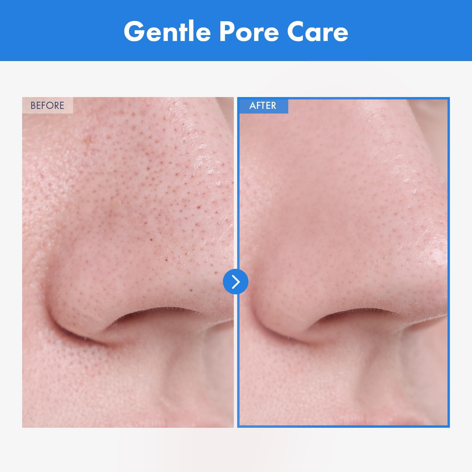 NATUREKIND NATUREKIND AHA Deep Cleansing Facial Oil with Jojoba Oil, Tea Tree Oil, PHA and Centella Asiatica, Korean Blackhead Remover, Pore Cleaner and Sebum Remover, 145ml, 4.9 fl. oz.