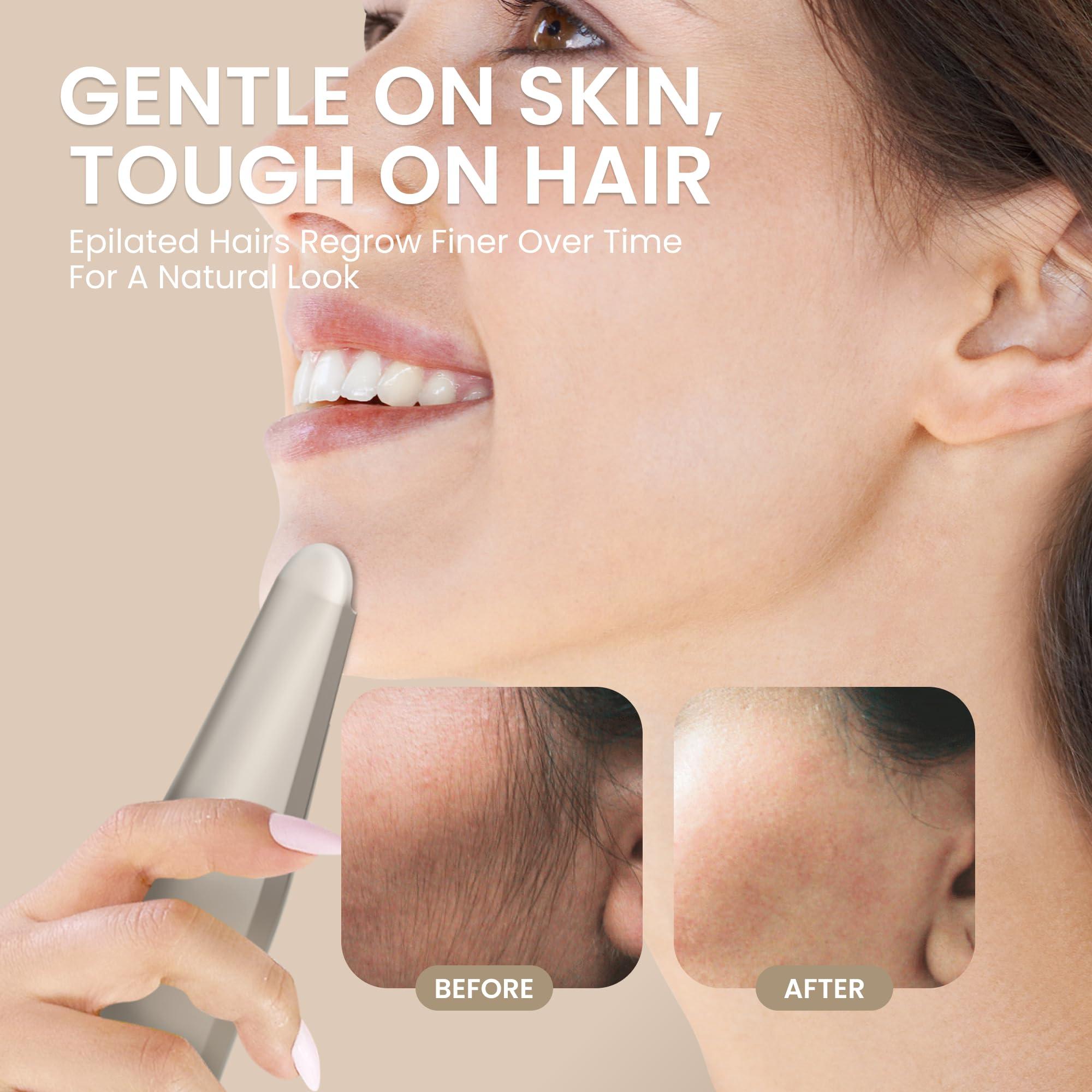 Epilady Epilady Esthetic Pearl Epilator for Women Face, Womens Facial Hair Remover | Included Case & Cleaning Brush, Electric Tweezers for Women Facial Hair