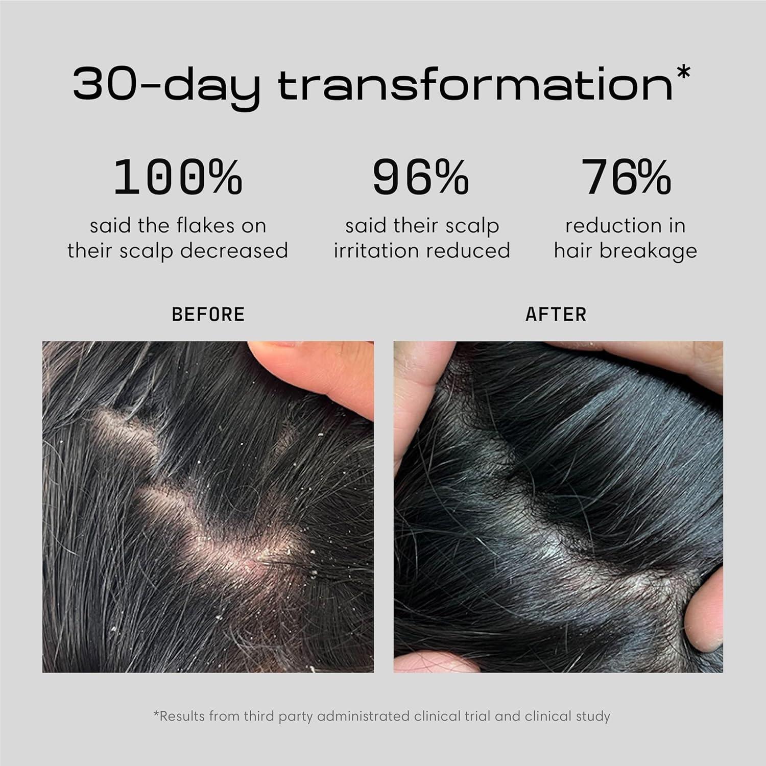 Jupiter Jupiter Anti-Dandruff Shampoo, Conditioner, & Serum Advanced Set, Physician-Formulated for Dry, Itchy, Oily, Flaky Scalp Care, Color-Safe, Dry Scalp, Sulfate-Free