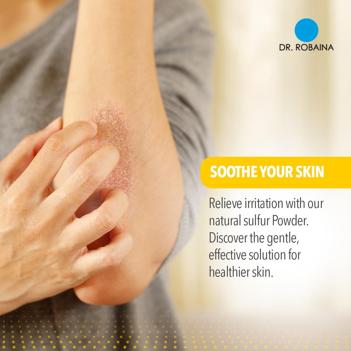 Dr. Robaina Dr. Robaina Sulfur Balsam Lotion Daily Moisturizing Lotion for Eczema and Psoriasis Relief Soothes Redness, Hydrates Sensitive Skin Natural Ingredients Made in the USA (Pack of 3)