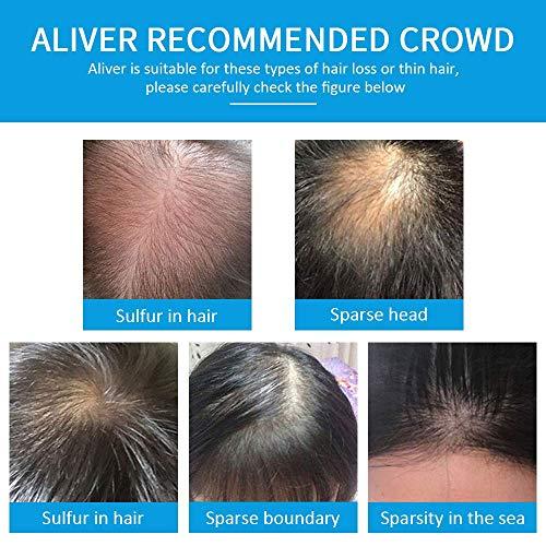 ALIVER Aliver Hair Fibers for Thinning Hair with Spray Dark Brown - Undetectable Natural Formula - Thicker Fuller Hair in 15 Seconds - Conceals Hair Loss & Look Younger - Designed for Men & Women,0.97Oz