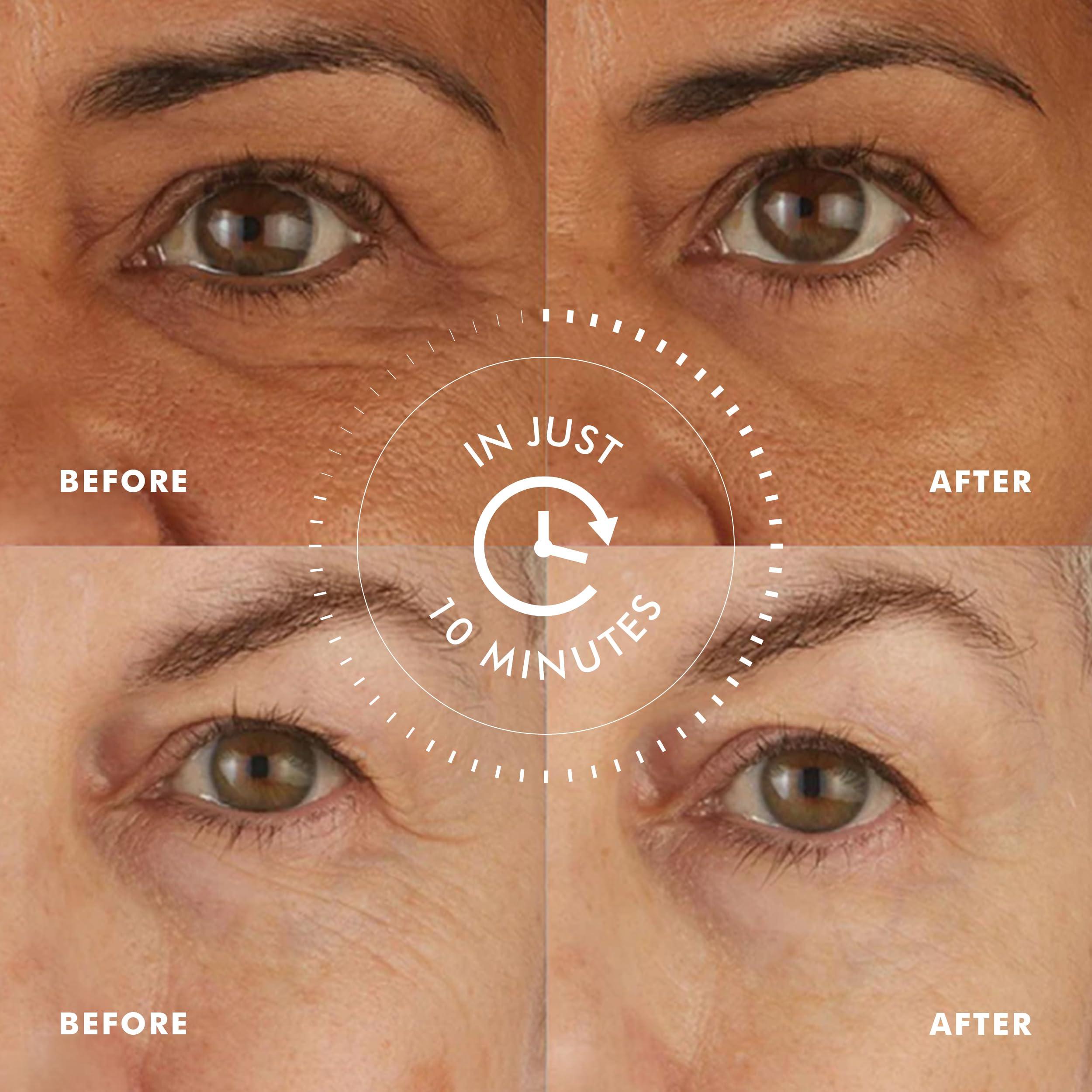 skyn ICELAND skyn ICELAND Hydro Cool Firming Under Eye Patches Eye Gel Mask To Firm And Reduce Wrinkles Fine Lines Dark Circles Puffiness Bags 16 Pairs