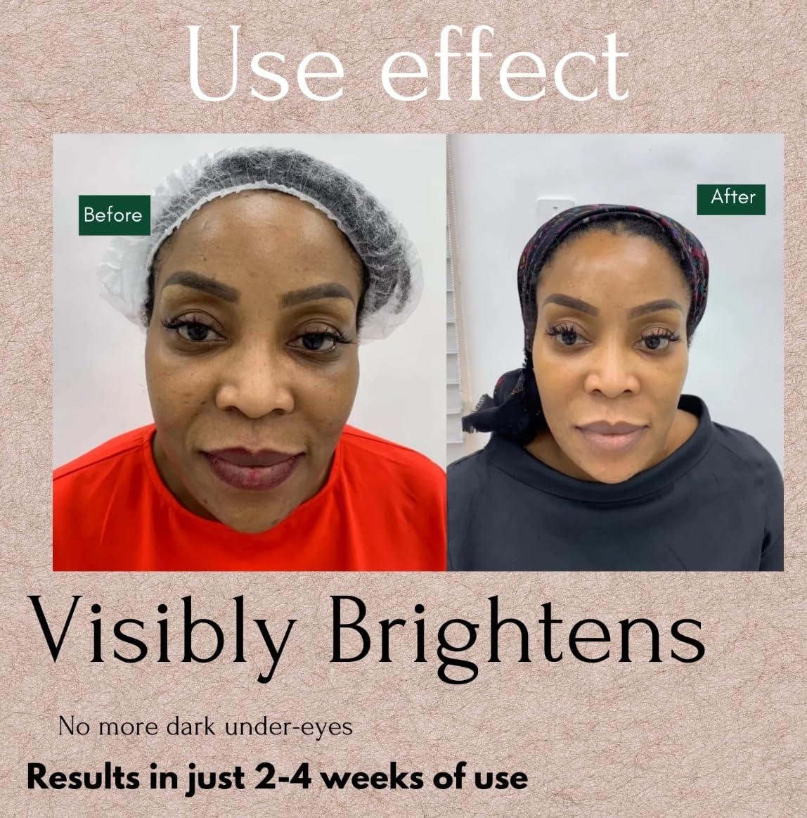 Unique Formulas Dark circles, Dark Under Eye Serum, Dark Circles Eraser serum 0.5 FL OZ