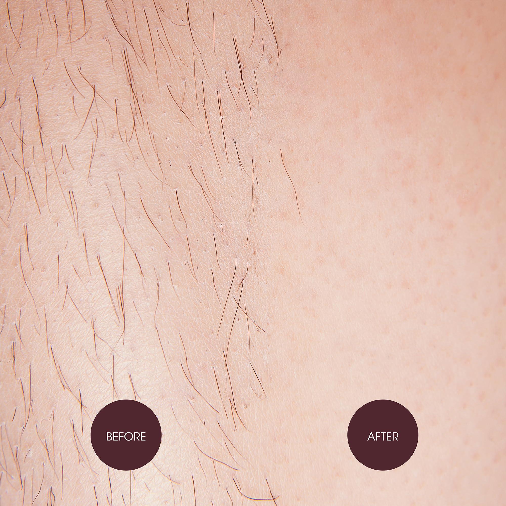 Nad's Nad\'s Hair Removal Waxing Dots - Cotton Candy Hard Wax Beads Kit - For Women - Microwaveable No-Strip Formula - Face, Body, Bikini, Underarms