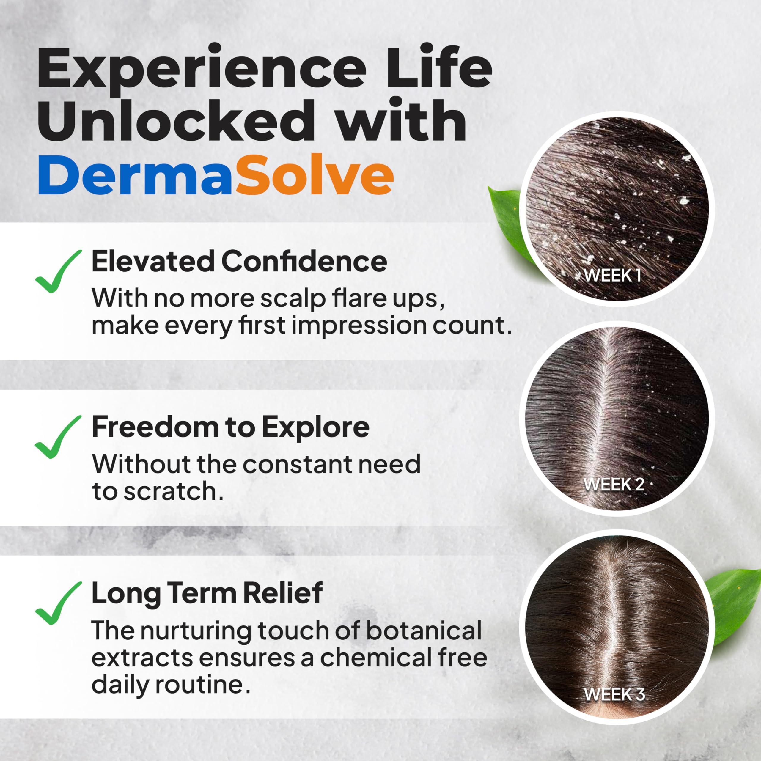 Dermasolve Dermasolve 4 oz Psoriasis, Seborrheic Dermatitis, & Dandruff Scalp Oil - Dermatologist Approved - Flaky Scalp Relief, Clinically Tested, Long-Lasting Itch-Free, High-Performance Formula