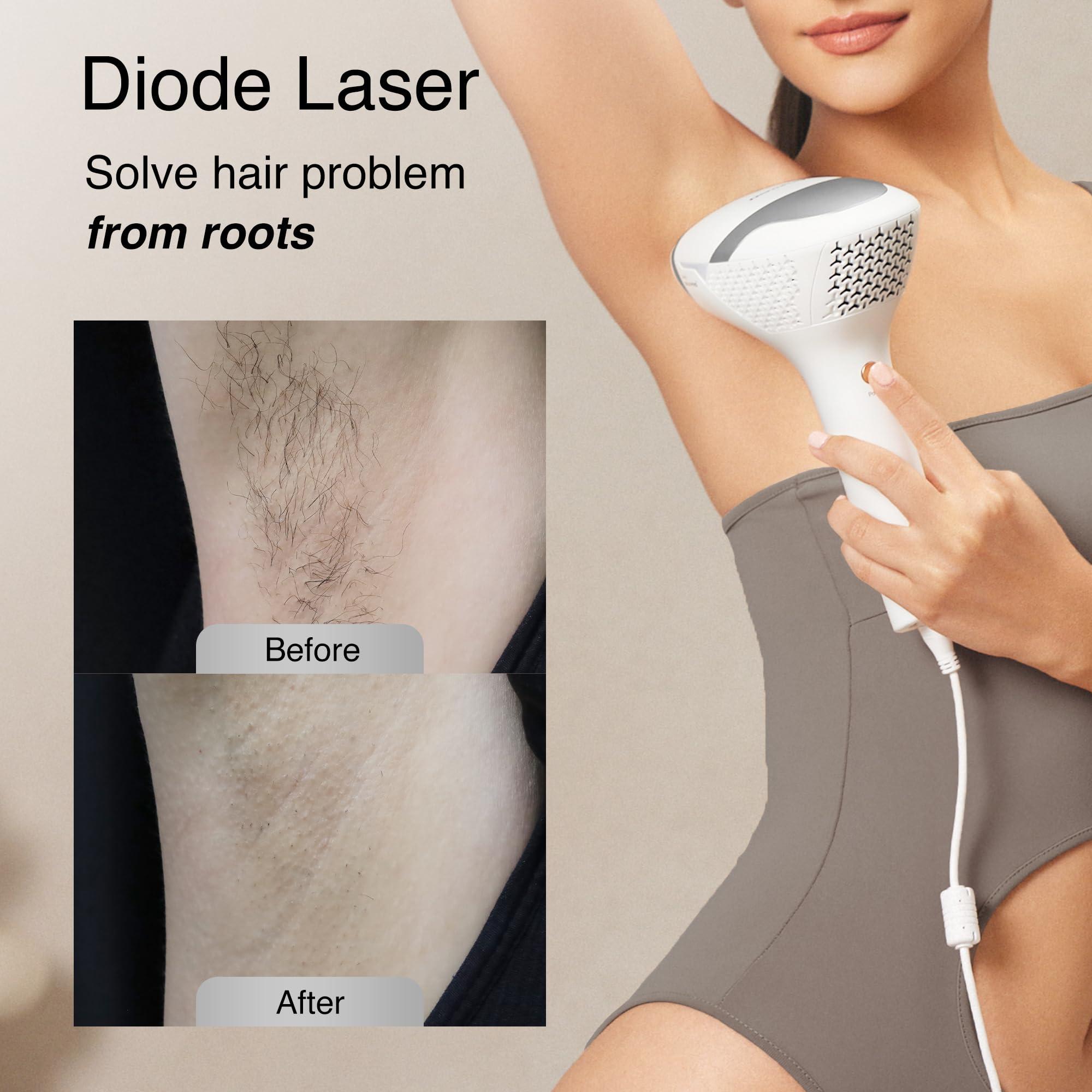 DermRays DermRays Diode Laser Hair Removal for Men and Women, V8S for Skin Tone 1-5, Permanent Reduction in Hair Regrowth, The World\'s First FDA-cleared Home-use Wide-Angle 810nm Laser Hair Removal Device