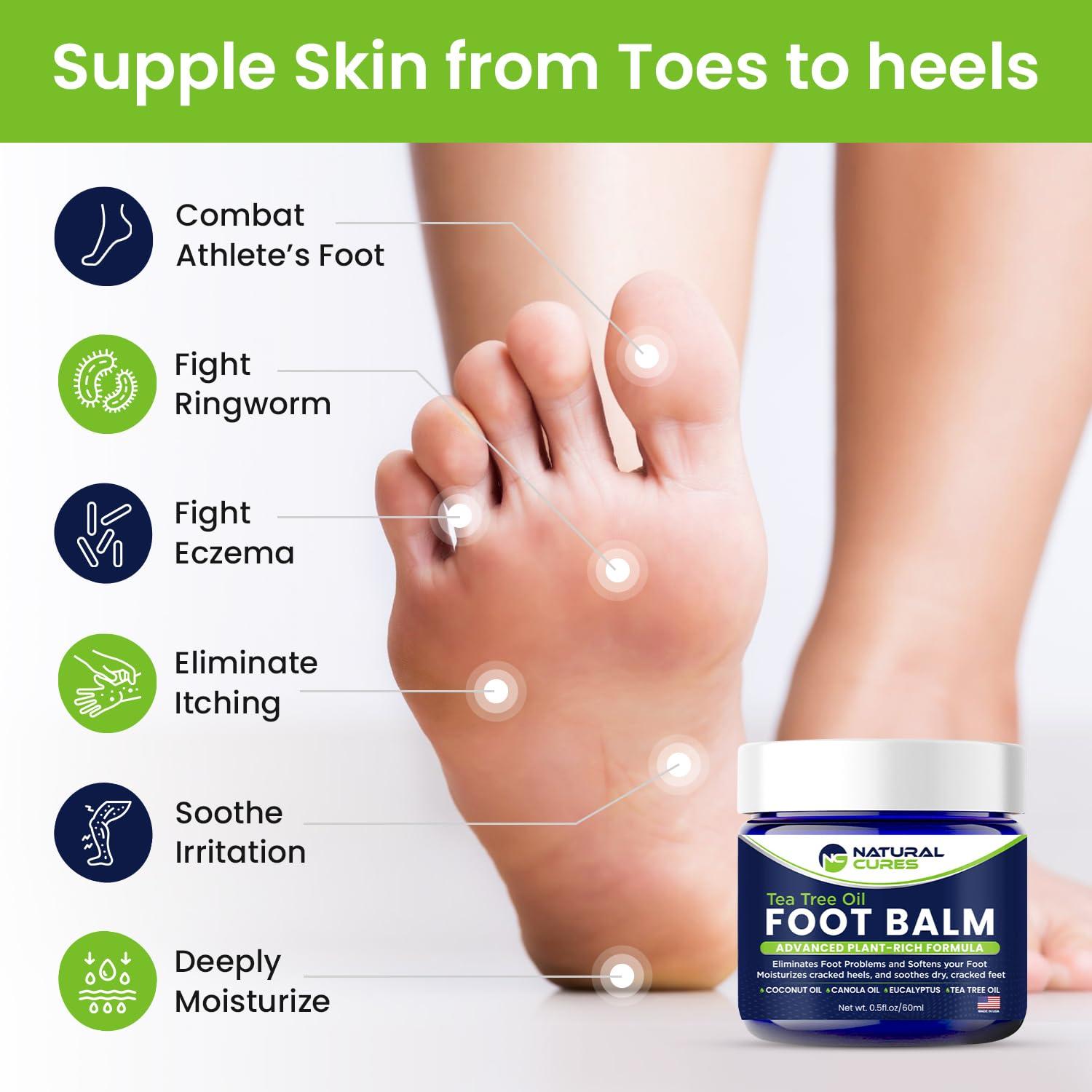 NC NATURAL CURES Tea Tree Oil Foot Balm - Instantly Hydrates Cracked Dry Feet and Callused Heels - All Natural Treatment Helps & Soothes Irritated Skin & Athletes Foot, Best Moisturizing Foot Care For Woman & Man - Made in USA
