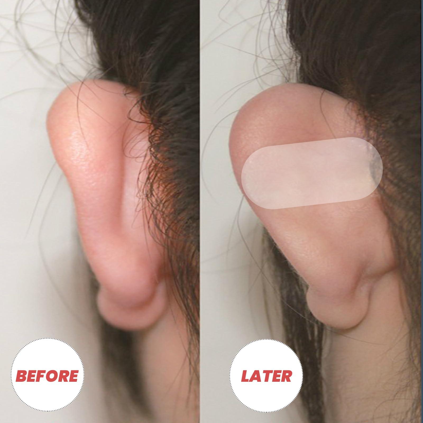 VILLCASE VILLCASE Women Ear Tape, 60pcs Ear Stickers Silicone Patches Ear Supply Ear Tape Cosmetics Ear Patch Correction Ear Patch Sticker Makeup Vertical Earmuffs Cosmetics Ear Tape