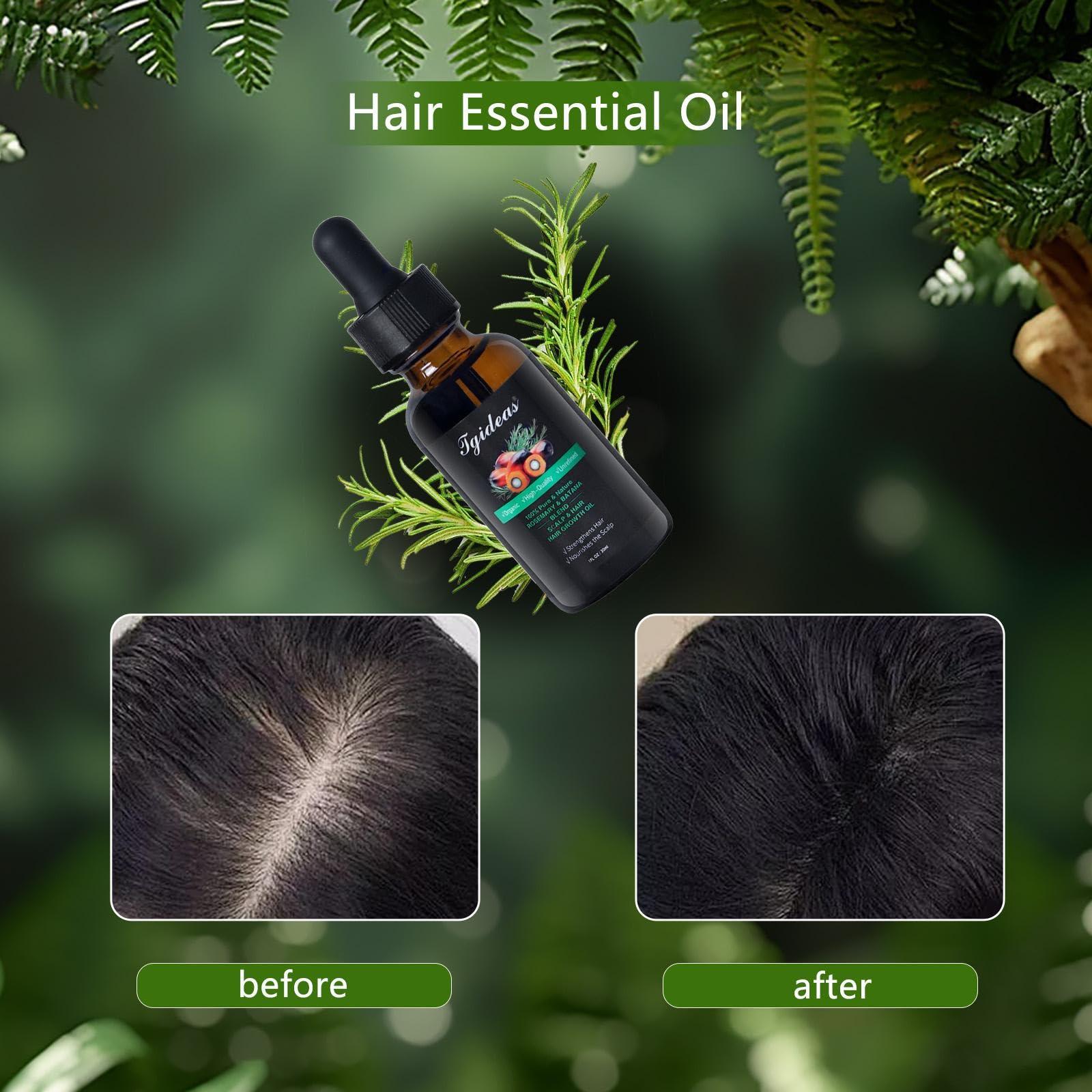Tgideas Tgideas Organic Rosemary Oil For Hair Growth Infused With Batana- Hair Strengthening Treatment Oil for All Hair Types-Prevents Hair Loss, Enhances Hair Thickness in Men& Women