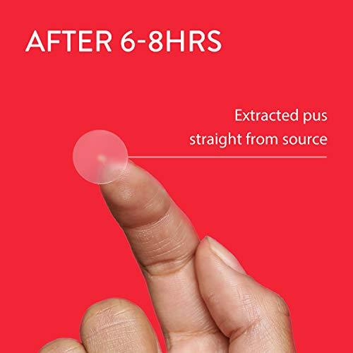 AVARELLE AVARELLE Acne Pimple Patch (40 Count) Absorbing Hydrocolloid Spot Treatment with Tea Tree Oil, Calendula Oil and Cica, Certified Vegan, Cruelty Free (VARIETY / 40 COUNT)