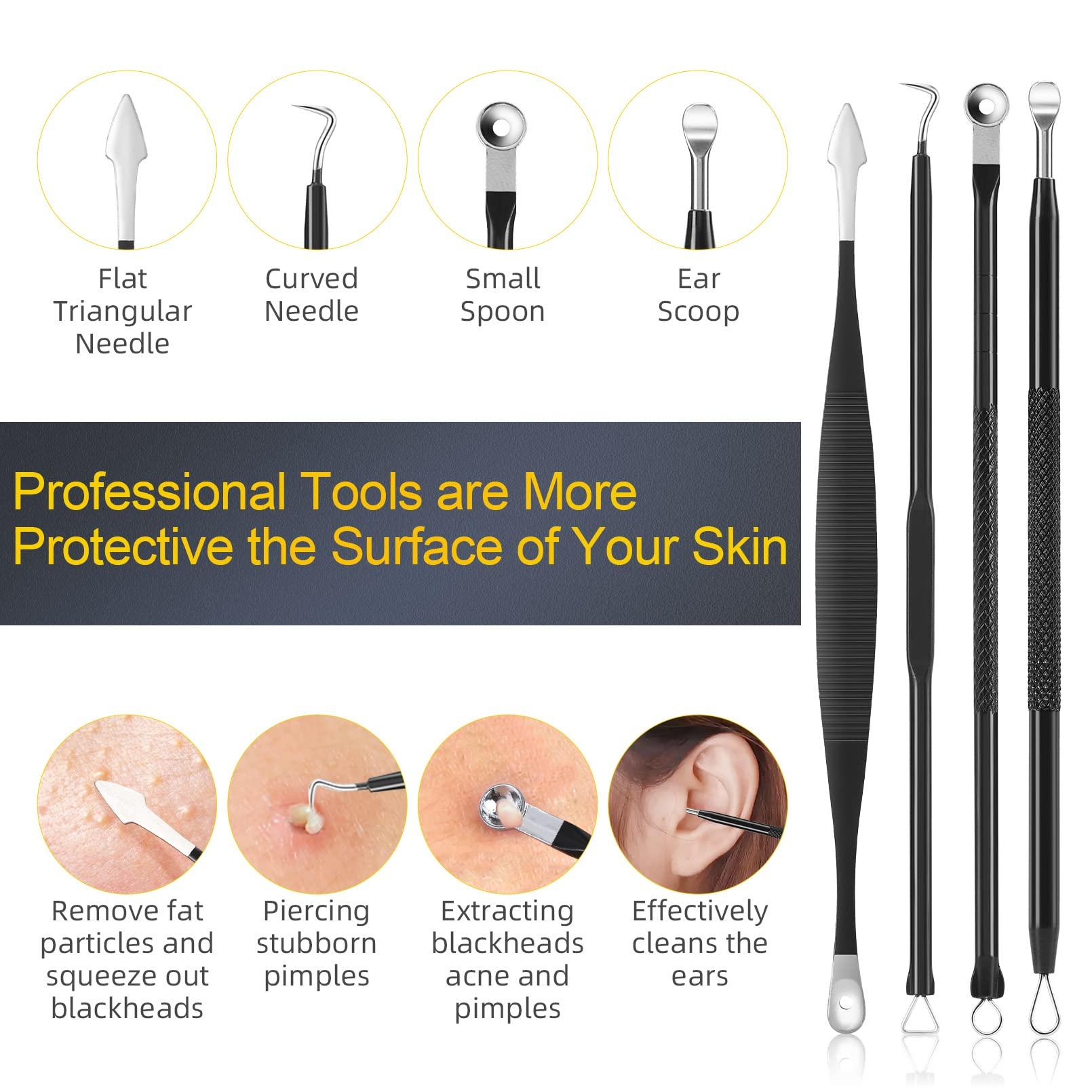 IUMAKEVP Pimple Popper Tool Kit, IUMAKEVP 15 PCS Professional Stainless Steel Blackhead Remover Comedone Extractor Tools for Removing Pimples, Blackheads, Zit on Face - Acne Removal Kit with Metal Case (Black)