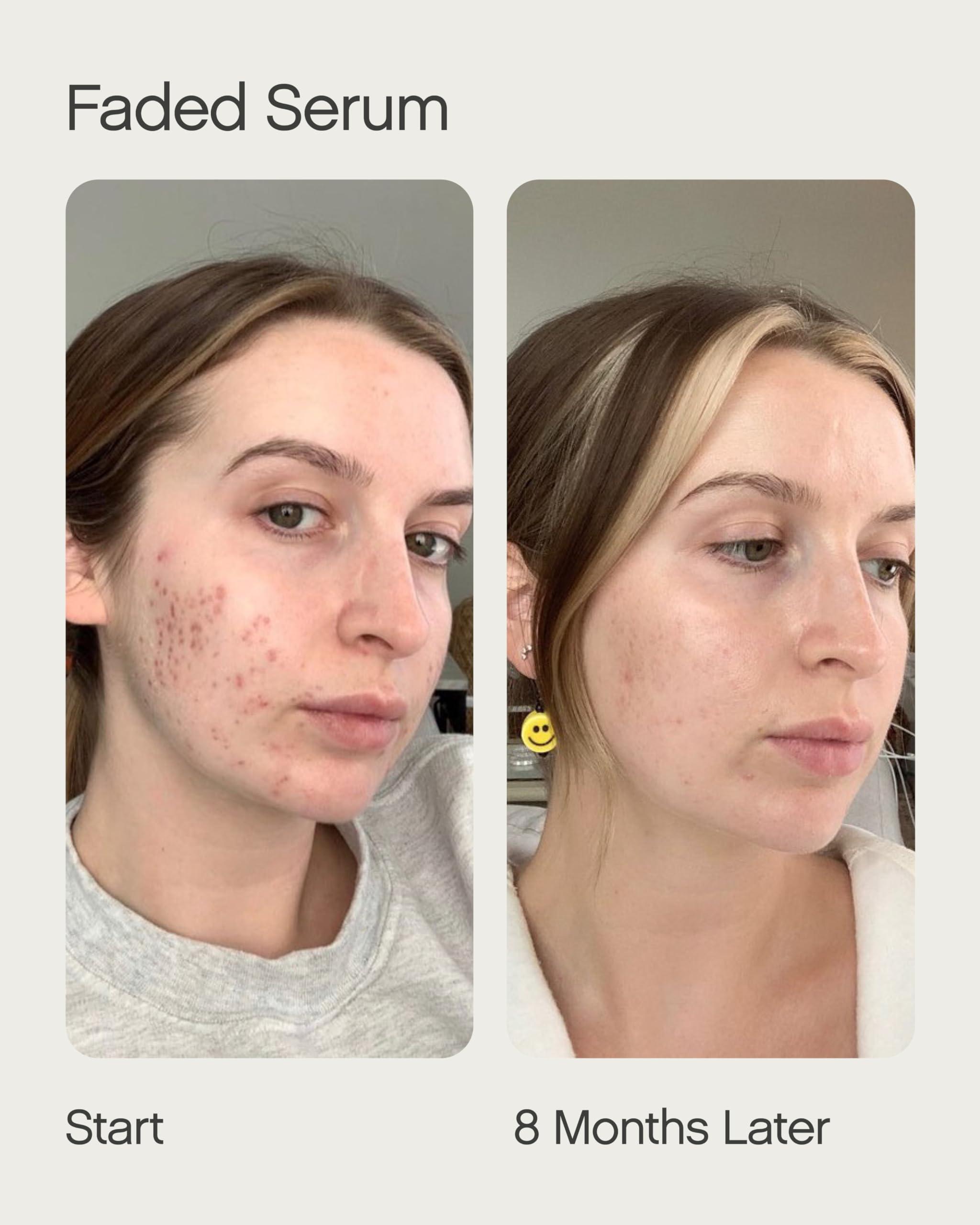 Topicals Topicals Faded Starter Kit, The Brightening & Clearing Bundle - Faded Serum for Dark Spots (0.5oz) and Faded Under Eye Masks (Set of 6)