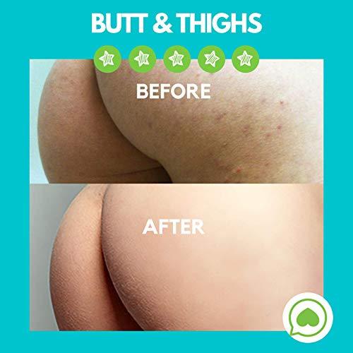 Green Heart Labs Brilliant Booty Kit | Butt Acne Clearing Lotion and ExfoliMATE Magic Body Exfoliating Cloth for Soft & Young Skin (Black)