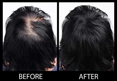 MAXX PRO-SERIES MAXX PRO-SERIES Volumizing Hair Fibers with real Keratin for Thinning Hair/Hair Loss – Dermatologist Tested and Certified Hypoallergenic - 60 days + supply - Multiple Colors Available (Dark Brown)