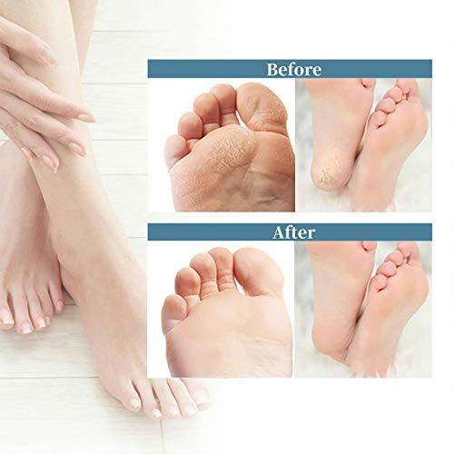 Hleane Electric Foot Callus Remover (Speed Adjustable), Portable Foot Sander, Professional Callous Remover for Feet with 60pcs Replacement Sandpaper Discs and 10 in 1 Pedicure Tools Kit, Pink