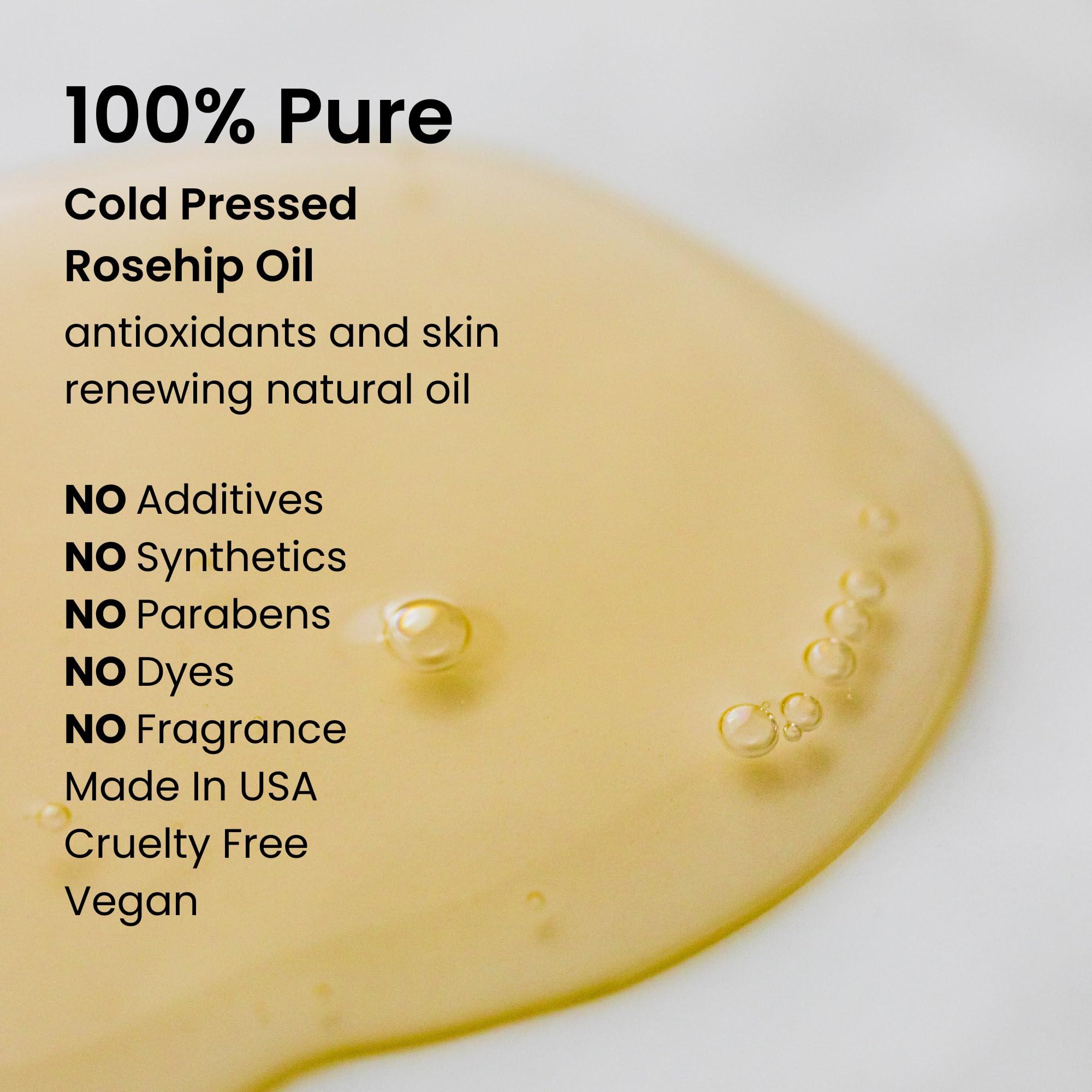 natural outcome natural outcome Rosehip Oil 100% Pure Cold-Pressed Rosehip Seed Face Oil - Anti-Aging Facial Oil to Plump, Balance & Hydrate 1 oz