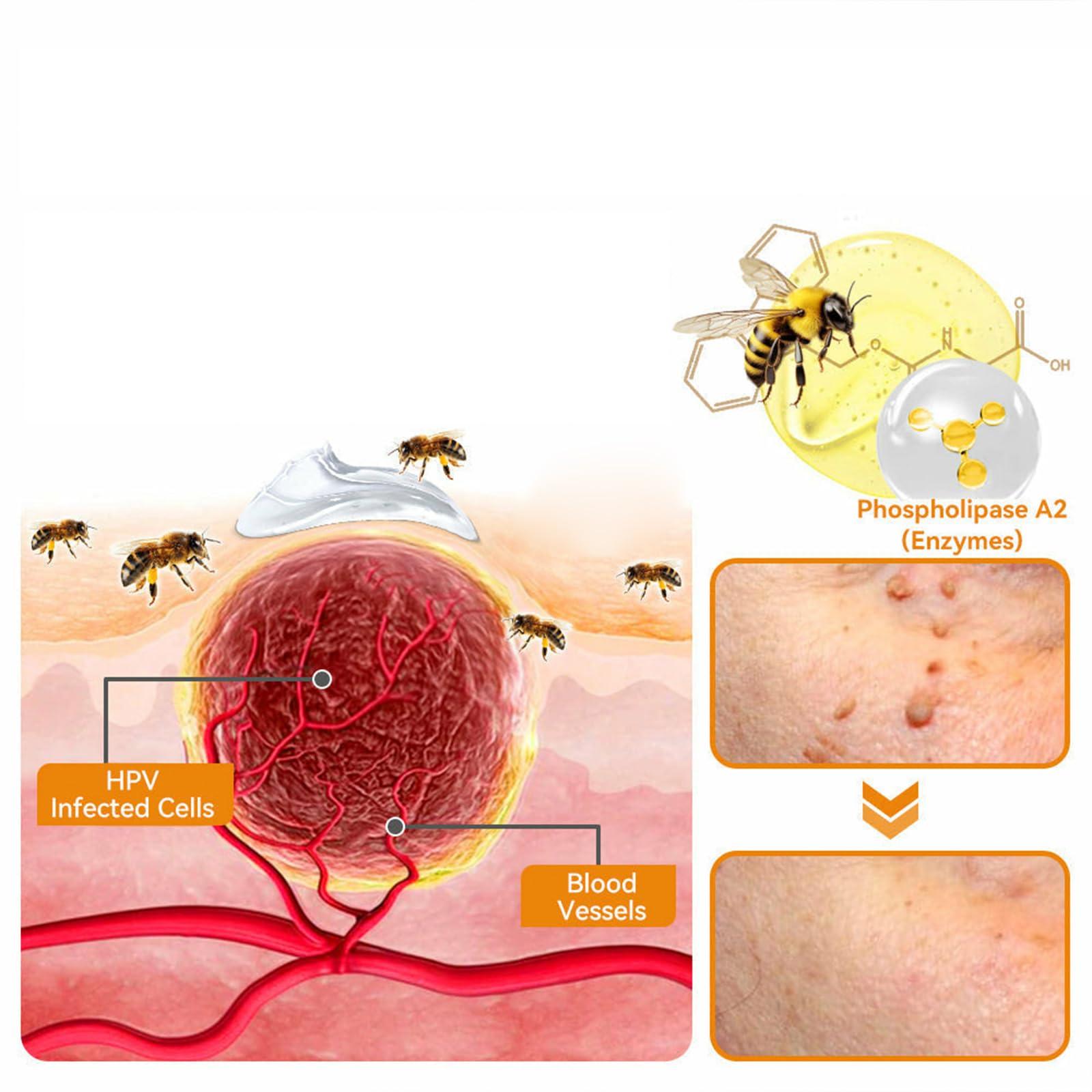 TLOPA TLOPA Bee Venom Treatment Cream, New Bee Venom Repair and Removing Cream,Hydrating Moisturizing Treatment cream for Men&Women,1Fl Oz (4)