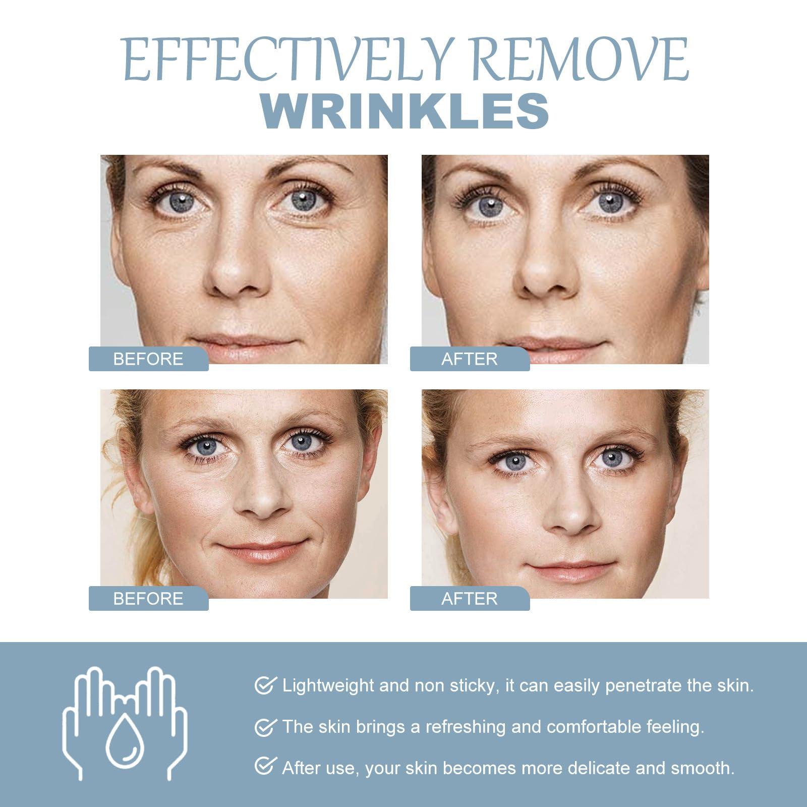 Fuxvao Crema de Baba de Caracol Original, Snail Mucin 92% Moisturizer Daily Face Gel Cream, Snail Mucin Serum, Crema De Caracol, Snail Secretion Filtrate Nourishing Cream,1.76oz (3)