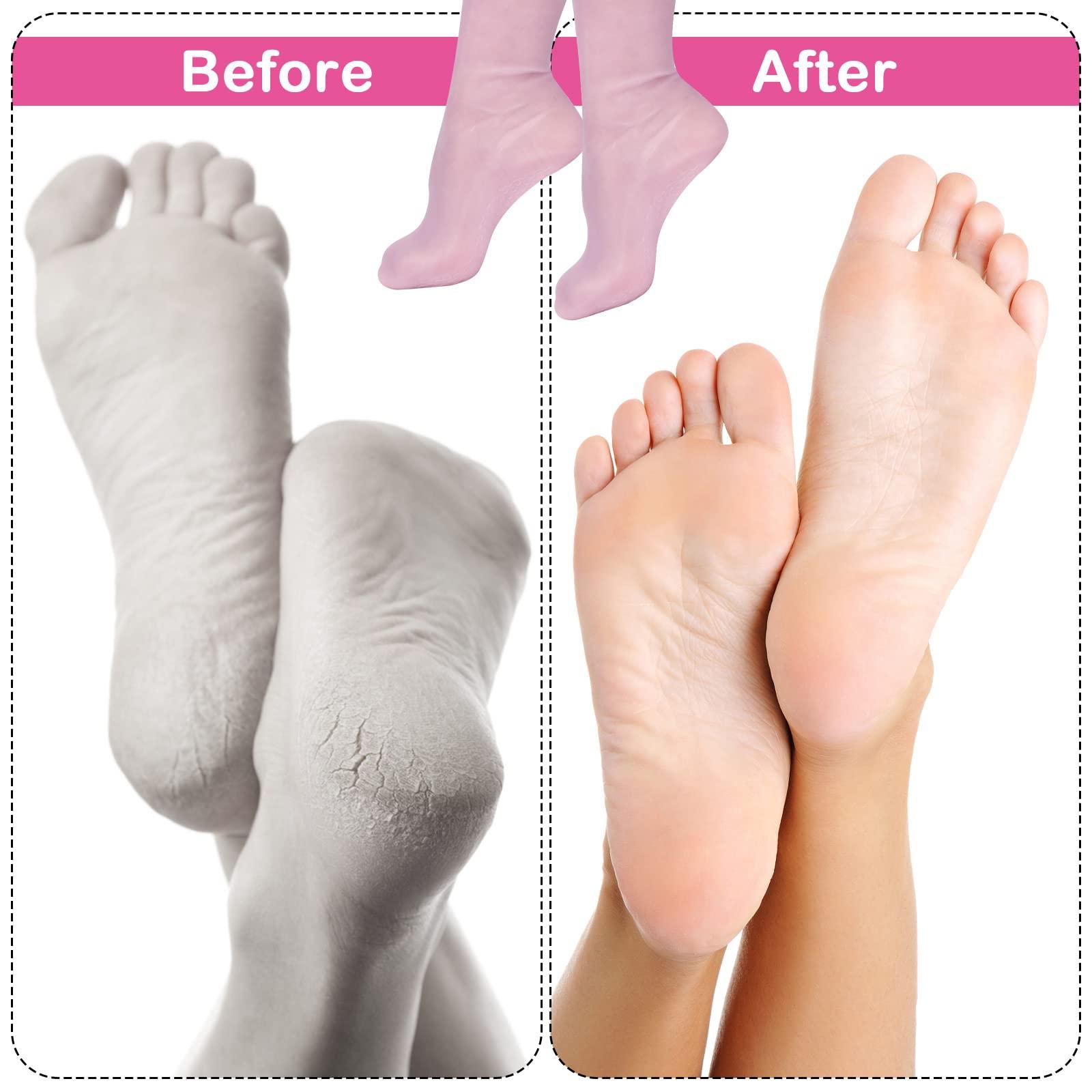 LUTER 2pcs Moisturizing Socks, Soft Silicone Socks Foot Moisturizing Socks Comfortable Gel Socks for Women Moisturizing Feet Softens Prevents Cracking