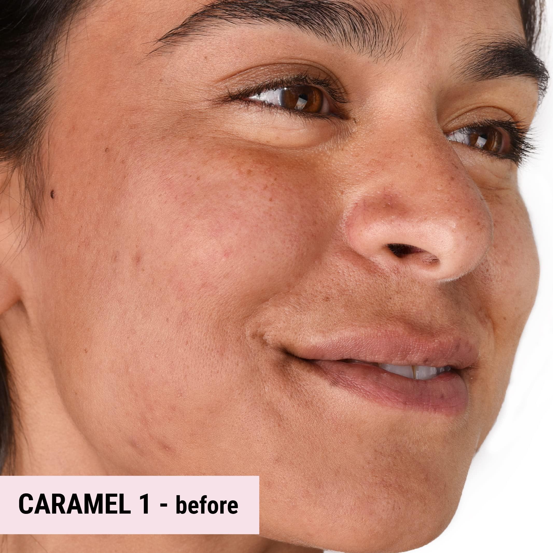 THE GOOD MINERAL The Good Mineral Loves-You-Back 3in1 Mineral Powder Foundation (CARAMEL 1) | Designed for acne-prone, sensitive skin reducing the appearance of acne and scars without layers | Vegan + Cruelty Free