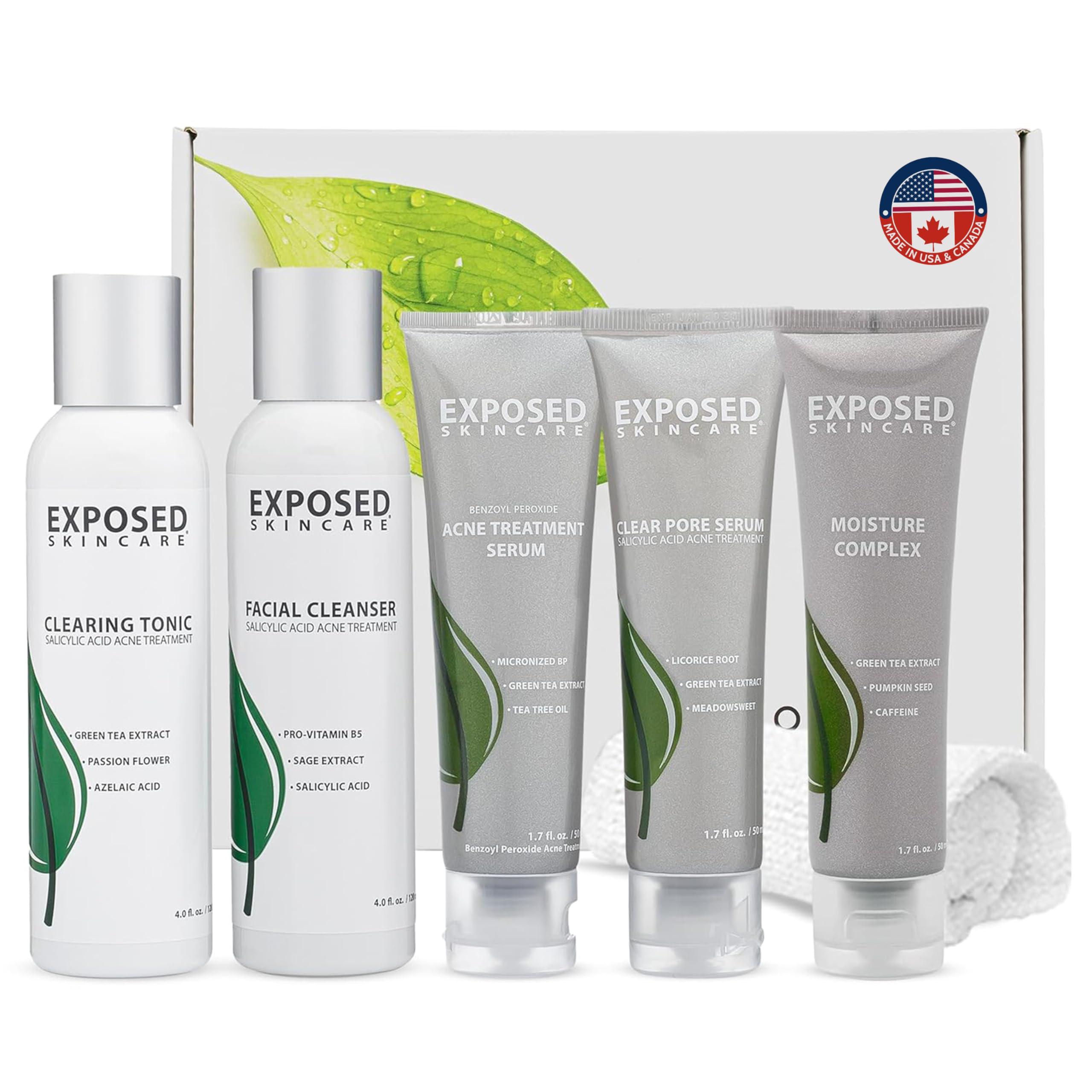 Exposed Skin Care Exposed Skin Care Expanded Acne Treatment Kit - Includes Salicylic Acid Face Wash, Clearing Tonic, Treatment Serum with Benzoyl Peroxide, Clear Pore Serum, Moisture Complex - Made for All Skin Types