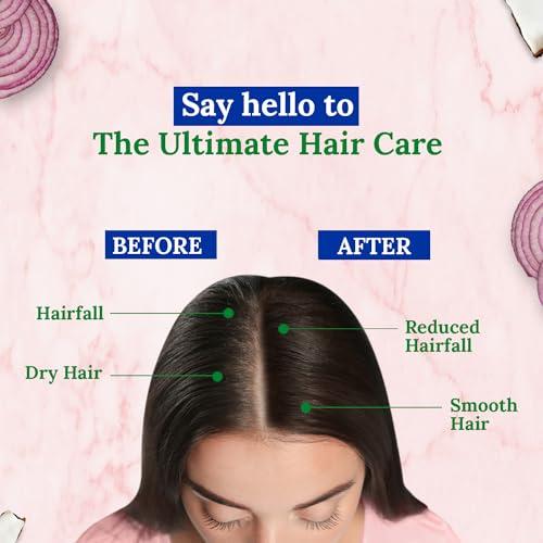 Parachute Advansed Parachute Advansed Onion Hair Oil with Natural Coconut Oil & Vitamin E, 6.7 Fl.oz. - For Longer, Stronger, Healthier Hair, Promotes Growth, Hair Fall Control, All Hair Types, Blue