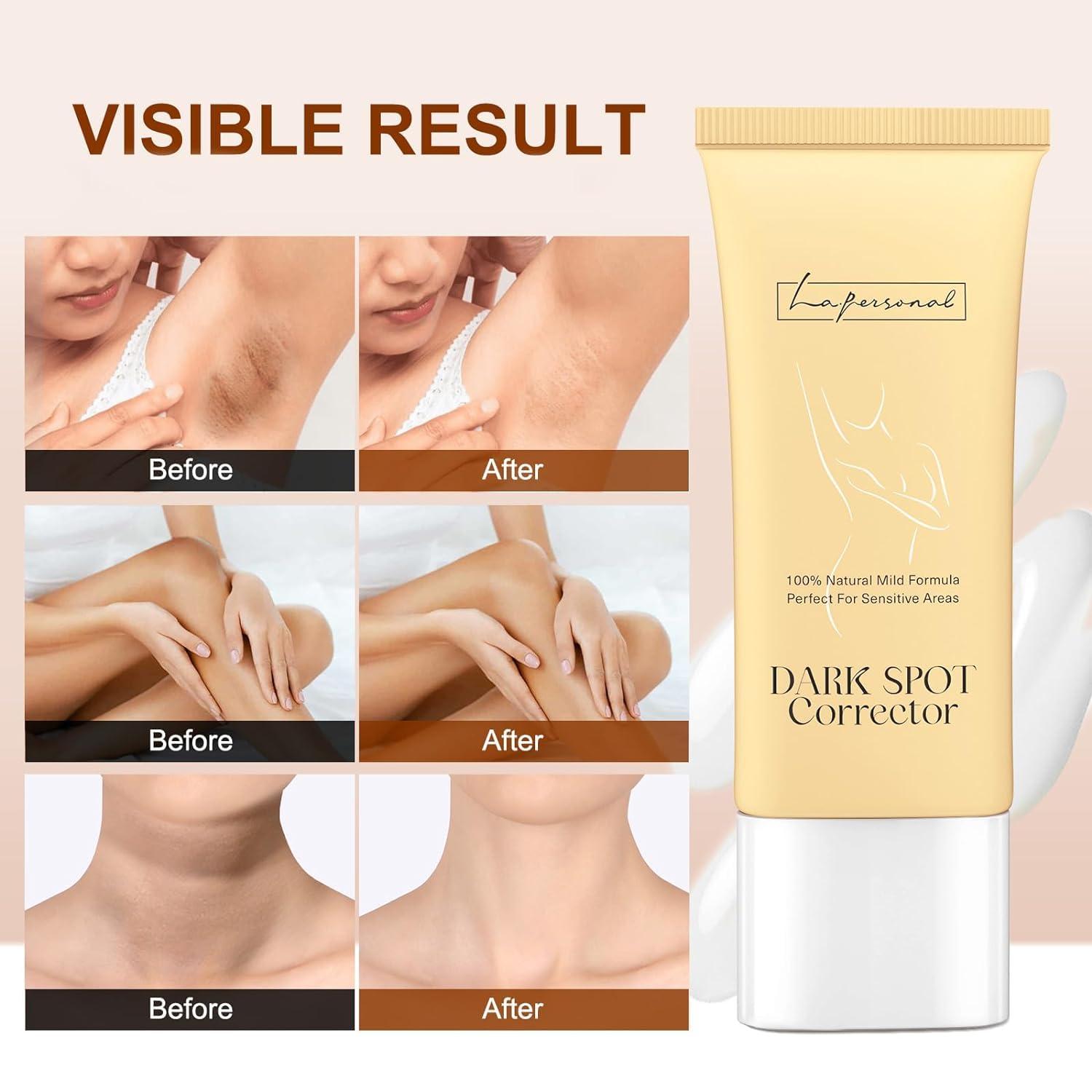 LA.PERSONAL LA.PERSONAL Neck Firming and Tightening Serum and Dark Spot Corrector