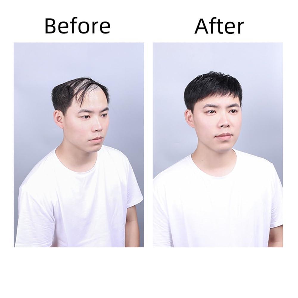 BeLongsYou Men Forehead Toupee, Hair Clip/Glue in Hair Replacement System Wig, Human Hair Piece PU Thin Skin for Hair Lose Hand Made,Short,16x21cm