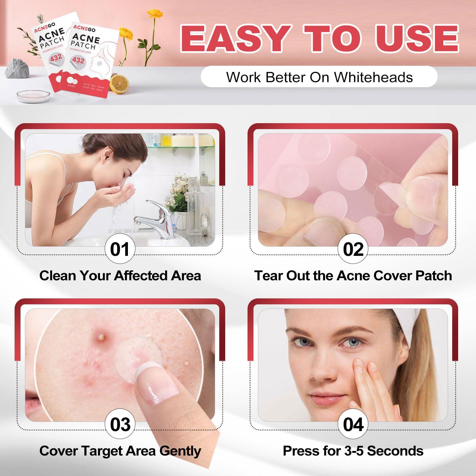 Beavorty Beavorty 15 Pcs Broken Hair Stickers Bangs Stickers Hair Clips for Styling Hair Bang Patch Hair Bang Pad Hair Pads Holders Letter Sticker Makeup Accessories Polyester Modeling Securing Clip