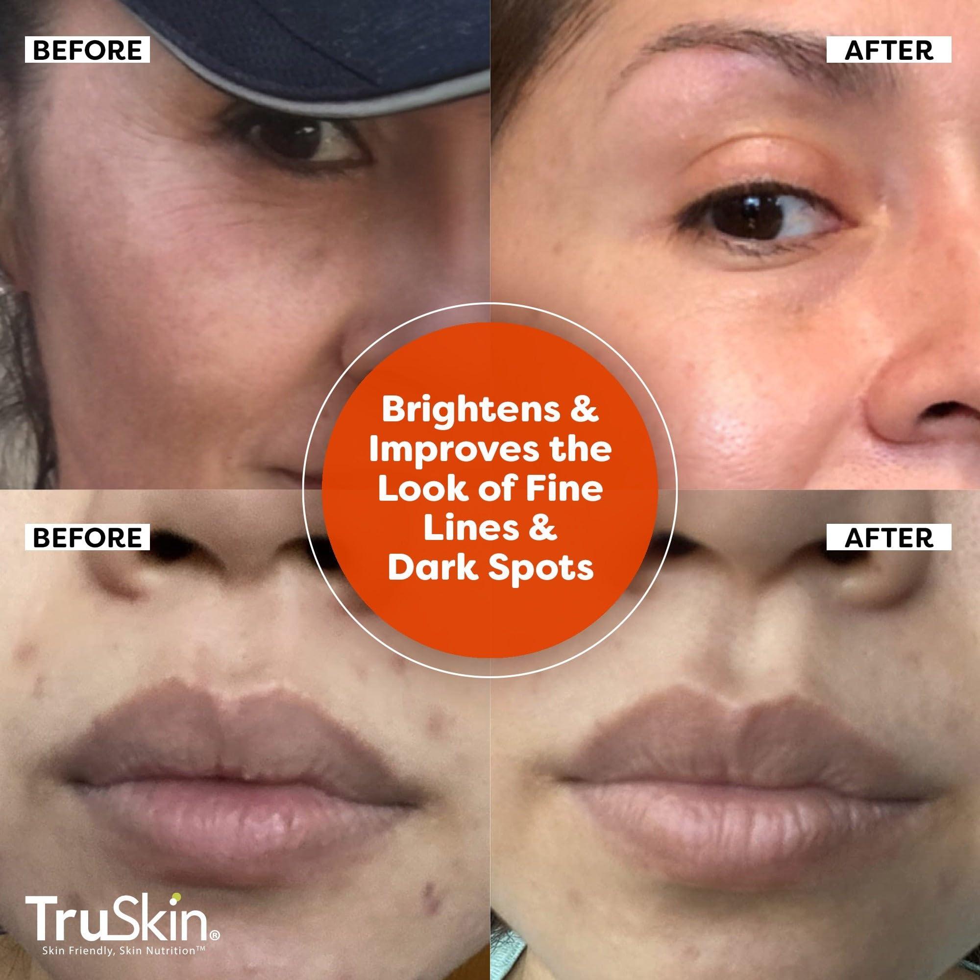 TruSkin Naturals TruSkin Vitamin C Serum & Vitamin C Scrub Duo for Brighter, Smoother and Glowing Skin