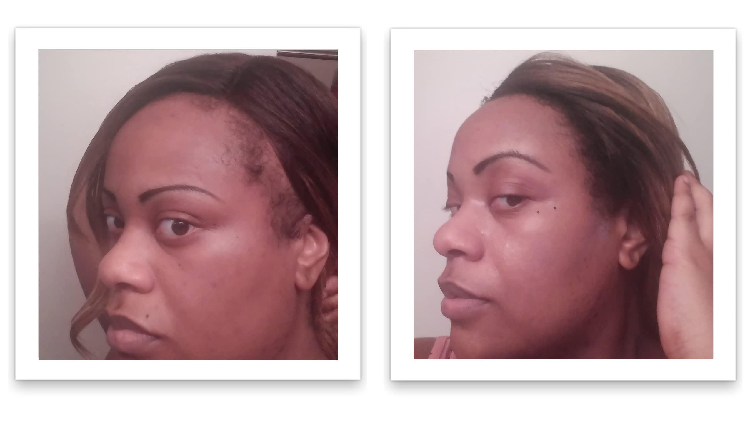 Caboki Caboki Hair Loss Concealer, All-Natural Hair Building Fiber. Make Thin Hair Look 10X Fuller Instantly. Eliminate the Appearance of Bald Spot and Thinning Hair (30G, 90-Day Supply). Black