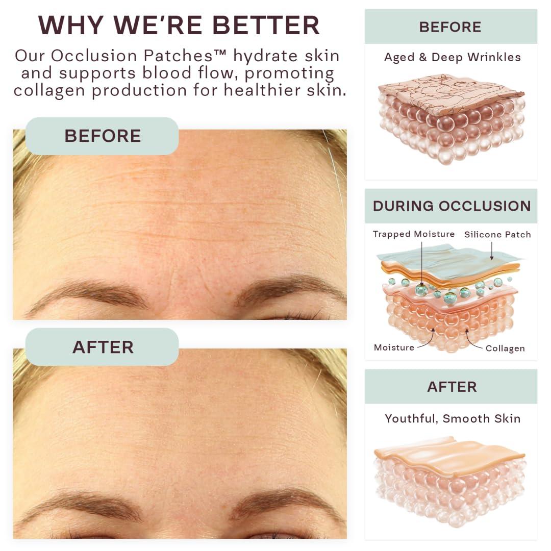 Dermaclara Dermaclara Silicone Face Patches - Anti-Wrinkle, Facial Mouth & Eye Patches - Hypoallergenic, Dermatologist Tested, Medical Grade Silicone Patches for Fine Lines & Wrinkles - Reusable up to 30 Uses