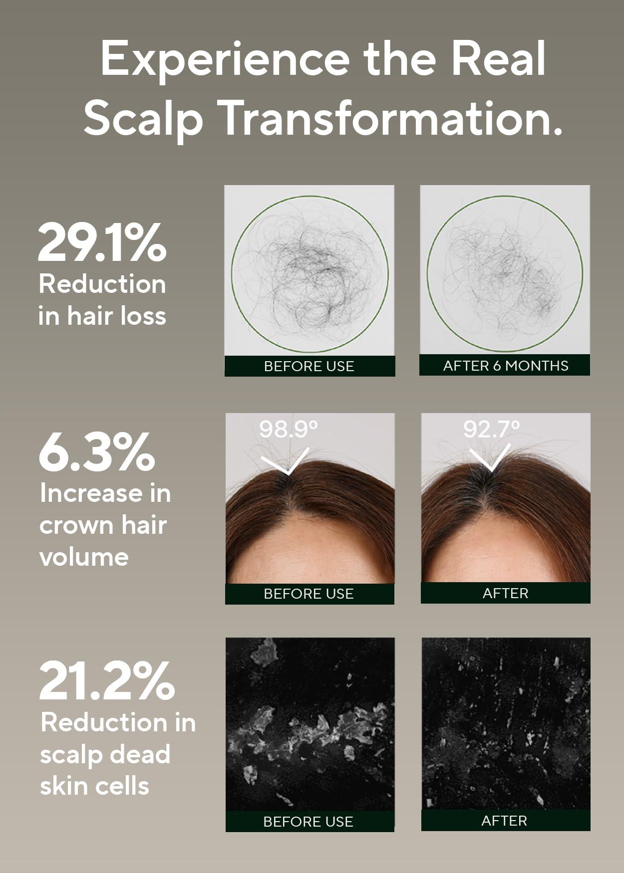 AROMATICA AROMATICA Rosemary Salt Scrub Shampoo 10.5 oz / 300g - Hair Loss Shampoo with Rosemary Scalp Oil | Scalp Exfoliator with Salt Scrub for Oily Scalp | Sulfate Free, Silicone Free