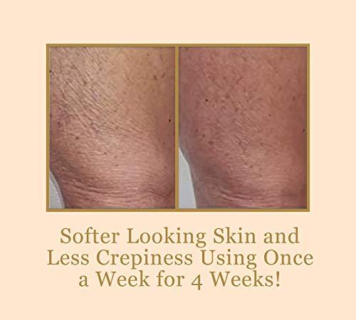 BEE STUNNING Bee Stunning DIAMONDBUFF Microderm Exfoliation Tool - At Home Professional BODY Diamond Crystal Microdermabrasion for Glowing Youthful Skin - Soften Crepey Skin, Fine Lines, & Improve Rough Texture!