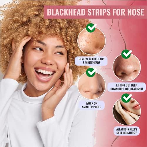 LOOKATME LOOKATME Nose Pore Strips (4-Pack, 20 Nose Strips). Korean Skin Care Blackhead Remover. K Beauty Blackhead Strips for Nose and Face, Black Head Strips Women. Acne Mask for Blackhead Removal. (Combo)