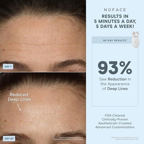 NuFACE NuFACE Trinity+ Microcurrent Facial Device Kit - FDA Cleared Face Sculpting & Neck Tightening Device to Contour Cheeks & Brows + Microcurrent Gel Activator, Silk Crme & Brush