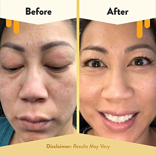 ECZEMA HONEY ECZEMA HONEY Soothing Facial Cream & 15% Vitamin C + Ferulic Acid Serum - Bundle for Sensitive & Dry Skin - Cruelty Free