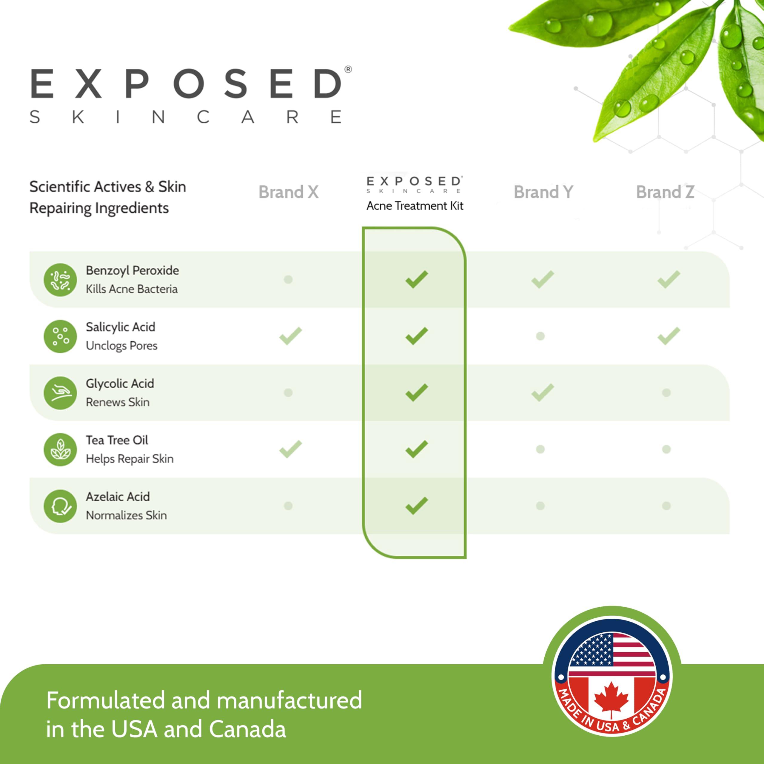 Exposed Skin Care Exposed Skin Care Basic Acne Treatment Kit - Includes Salicylic Acid Face Wash, Clearing Tonic, Acne Treatment Serum with Benzoyl Peroxide, Clear Pore Serum - Acne Set Solution for All Skin Types