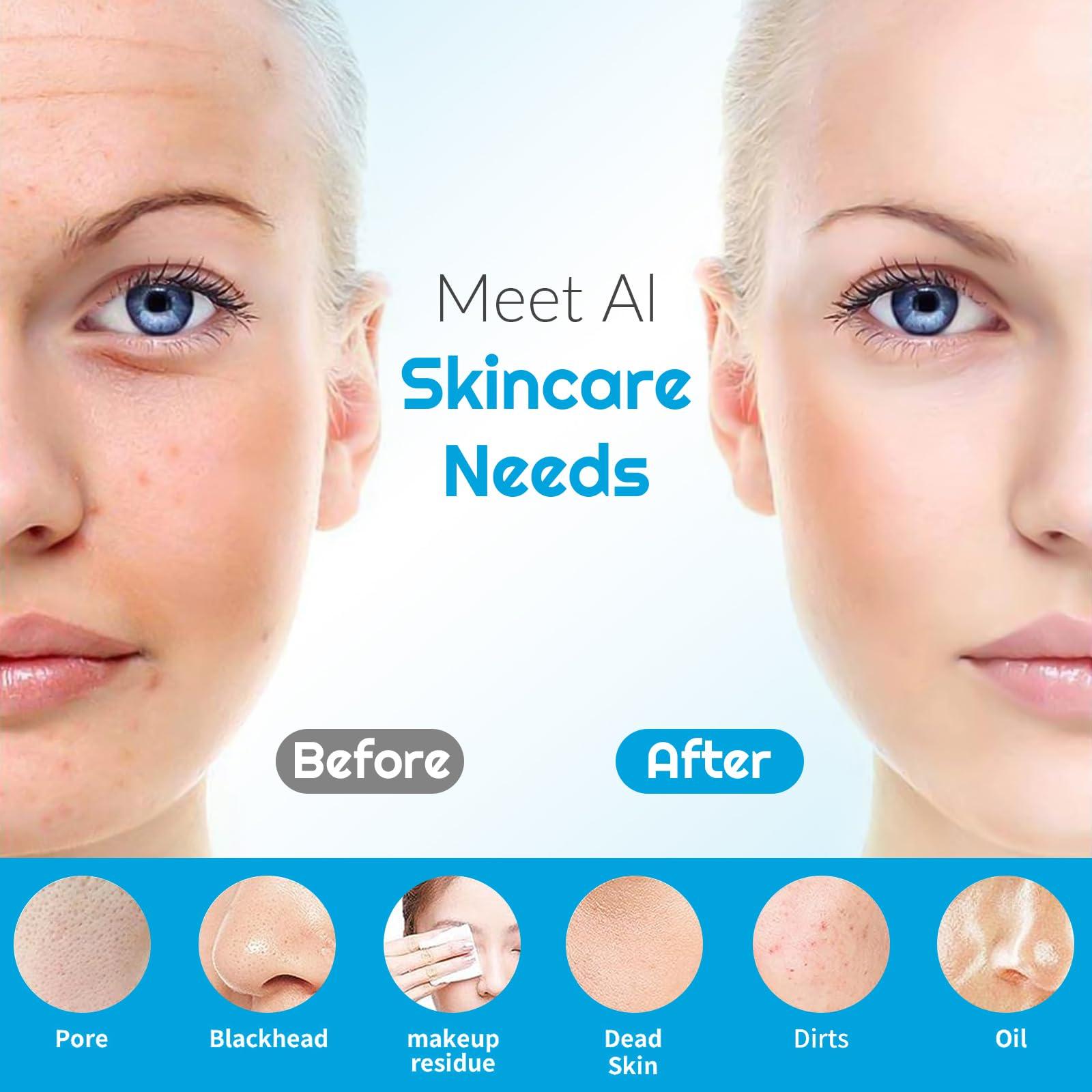 Landmore Landmore Silicone Face Scrubber, Waterproof Facial Cleansing Brush with Red Light Thermal Massage, Electric Face Scrubber with Nose Scrubber Exfoliator for Women/Men Deep Cleansing, Power Exfoliating