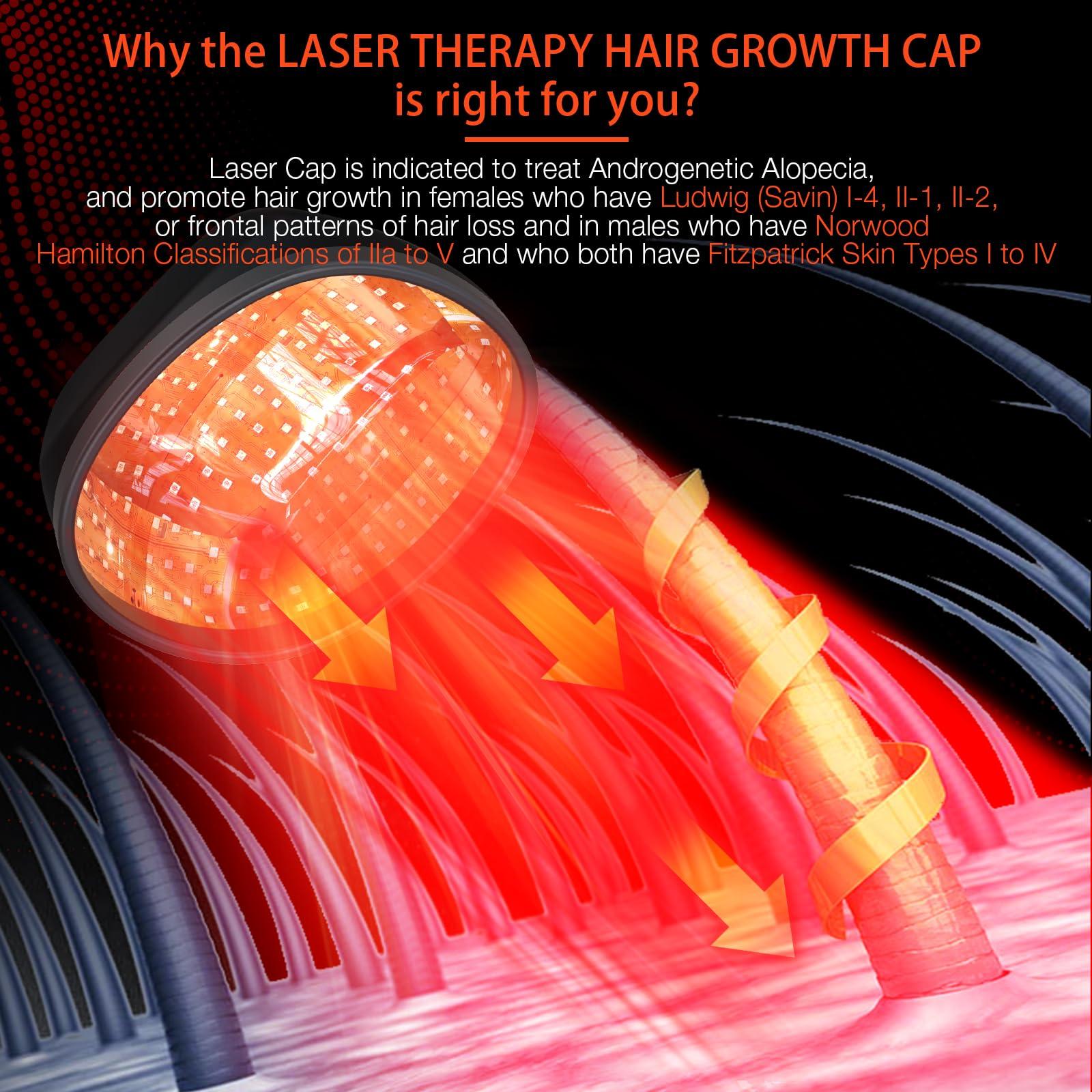 PUPCA PUPCA Laser Cap (FDA Cleared), Professional Medical Grade Lasers Hair Growth Treatment Product for Men & Women, Red Light Therapy for Hair Growth, Treat Alopecia