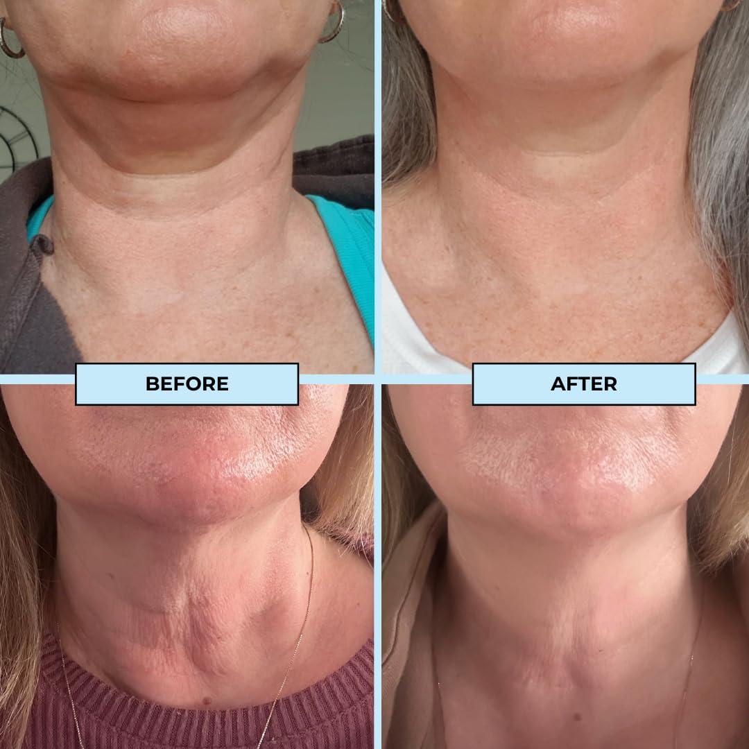 BOOST LAB BOOST LAB Edelweiss Neck Firming Serum - Reduce Neck Wrinkles & Neck Ageing - Lifts & Smooths Crepe-Like, Sagging Skin - Paraben Free, Sulphate Free, Fragrance Free - 30 ml (1 fl oz)