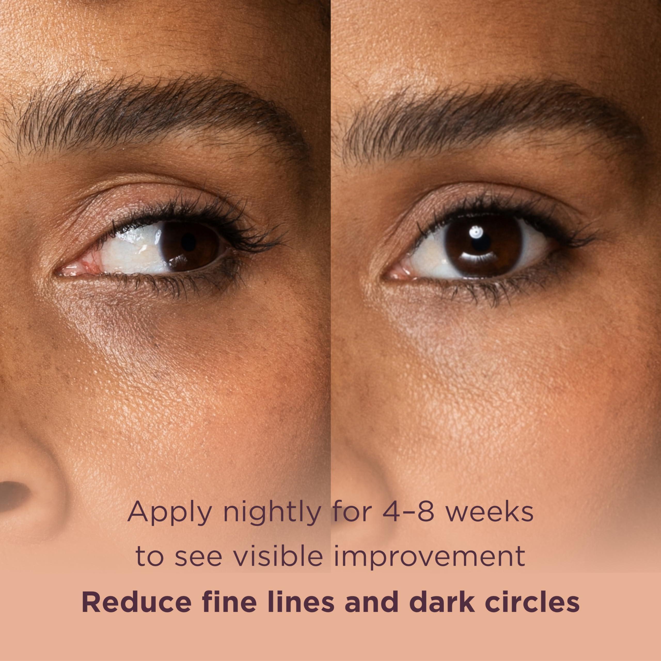 MATKAS MATKAS Korean Retinol Renew Under Eye Cream for Wrinkles, Fine Lines - 15mL Best Under Eye Brightener Cream for Dark Circles, Korean Skincare Retinol Serum for Anti Aging, Eye Bags Treatment for Women